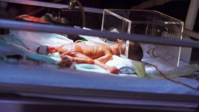 Premature newborn baby